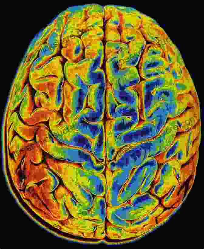 A Close Up Of A Human Brain Scan, With The Word 'consciousness' Superimposed On It. Monke S Guide To Consciousness Alexey Osadchuk